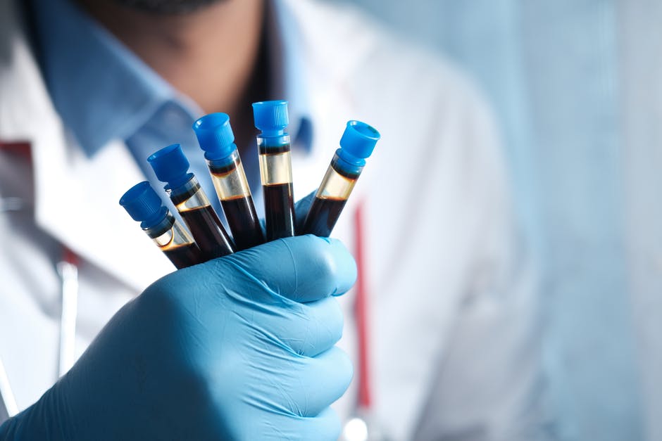 Will Blood Work Show Cancer on Tests?